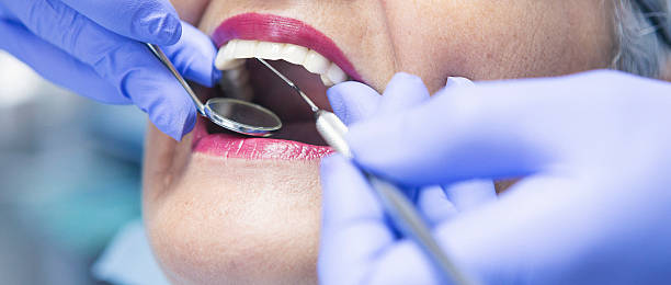 Best Emergency Dentist for Knocked-Out Tooth in Caddo Mills, TX