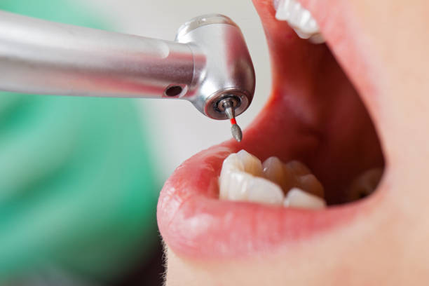 Best Emergency Dental Services for Seniors in Caddo Mills, TX